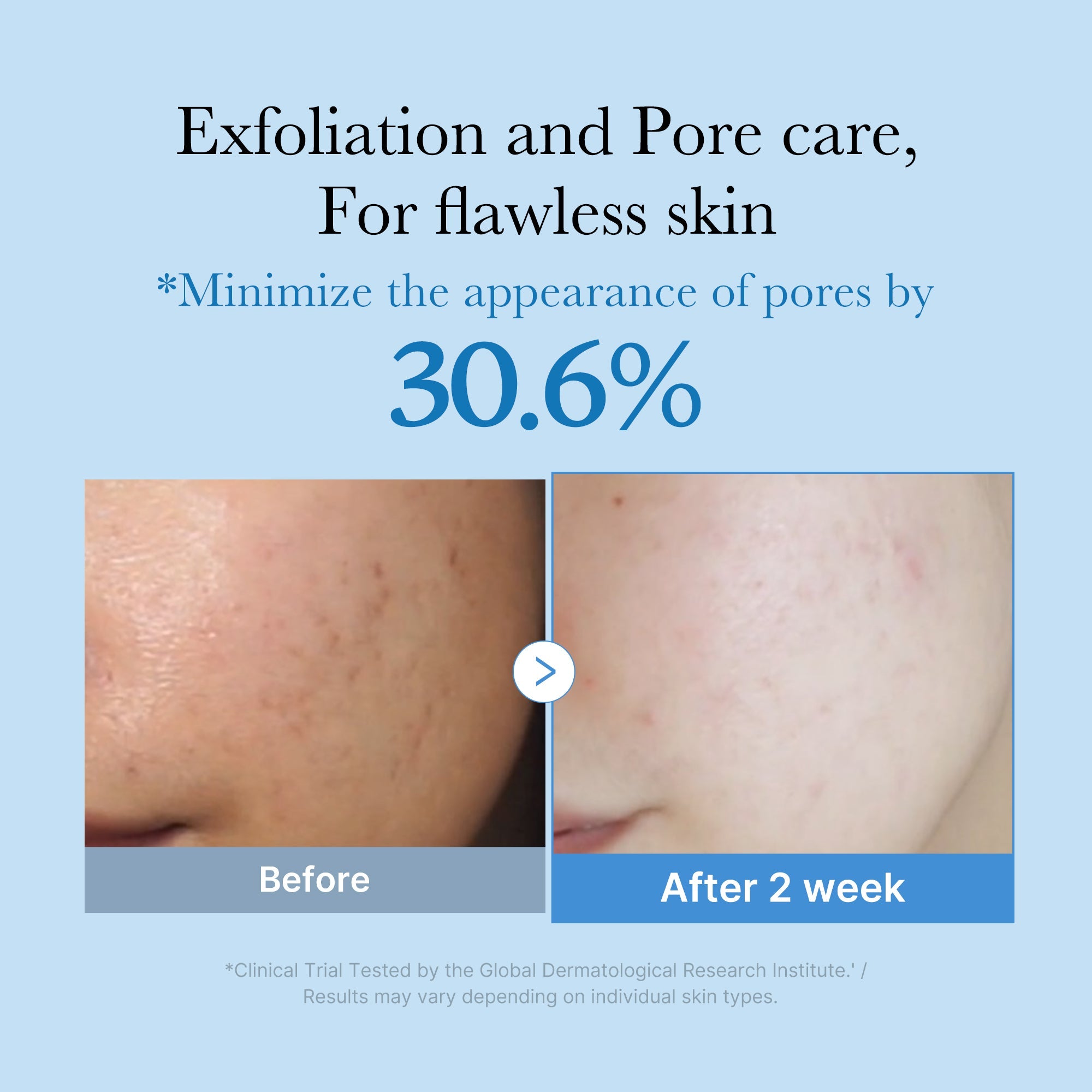Zero Pore Toner - More to love about care.