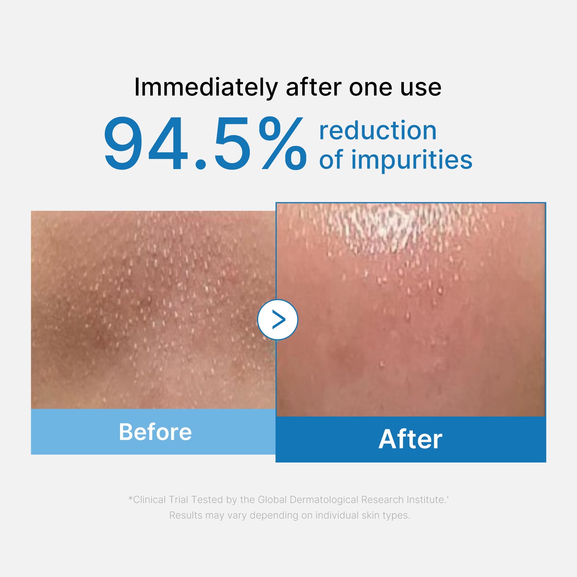 Zero Pore Blackhead Deep Cleansing Oil - Tonight has room for you.