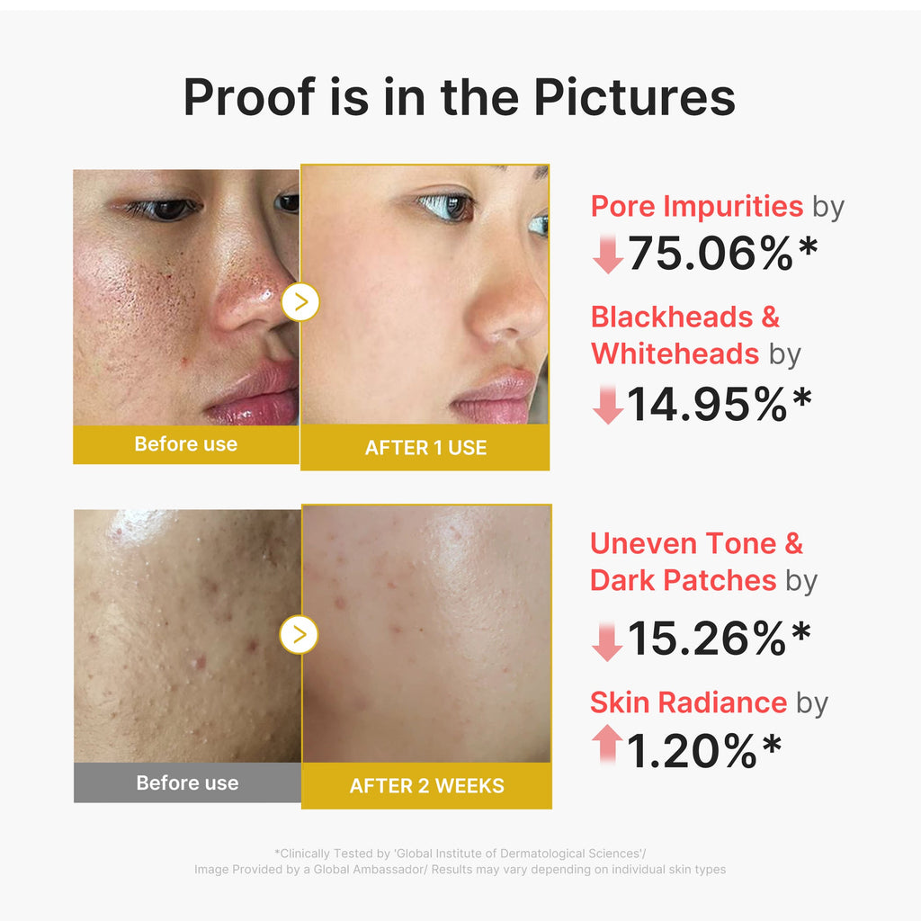 Kojic Acid Turmeric Peel Shot - Medicube is on your wishlist.