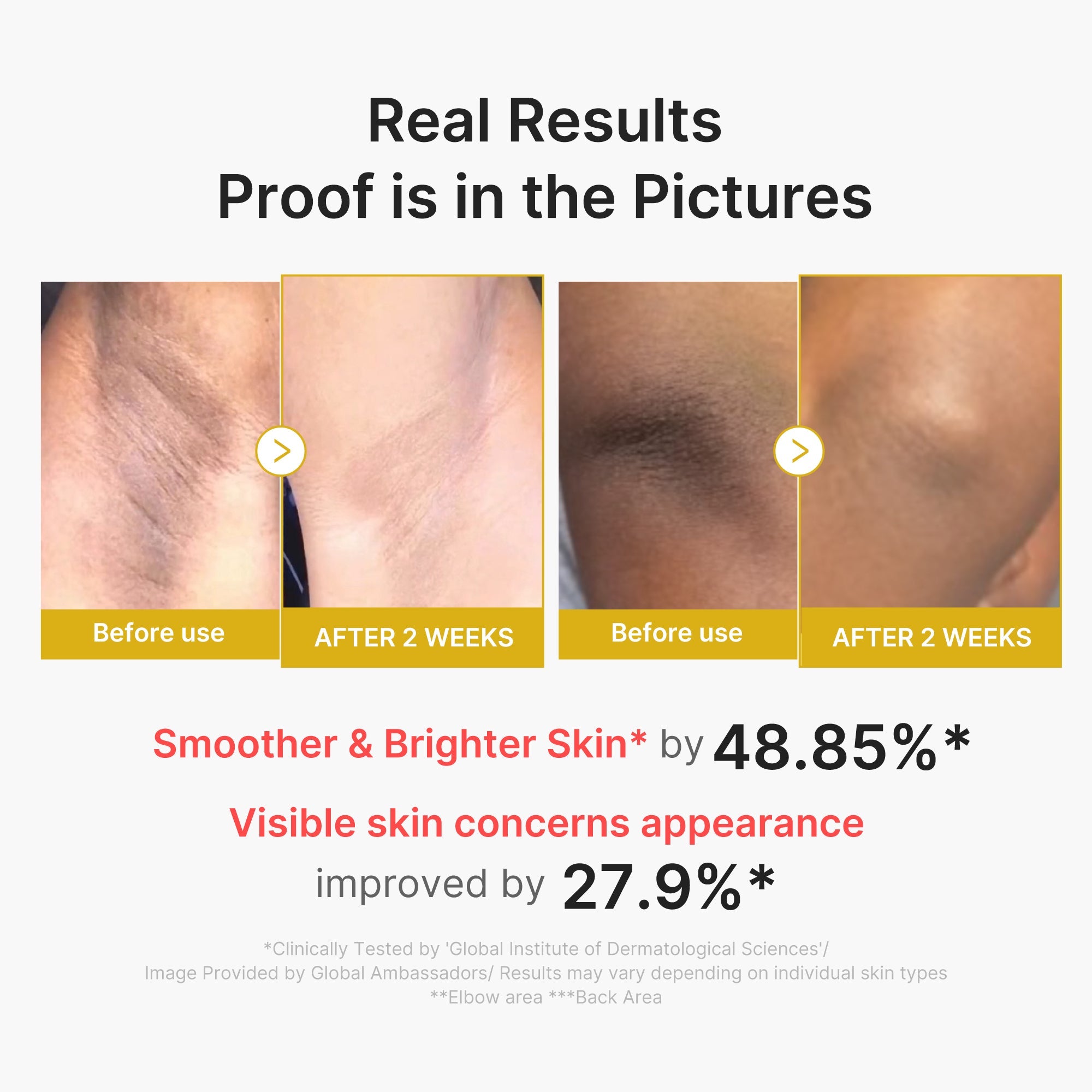 Kojic Acid Turmeric Body Peel Shot - Leave room for self-care.