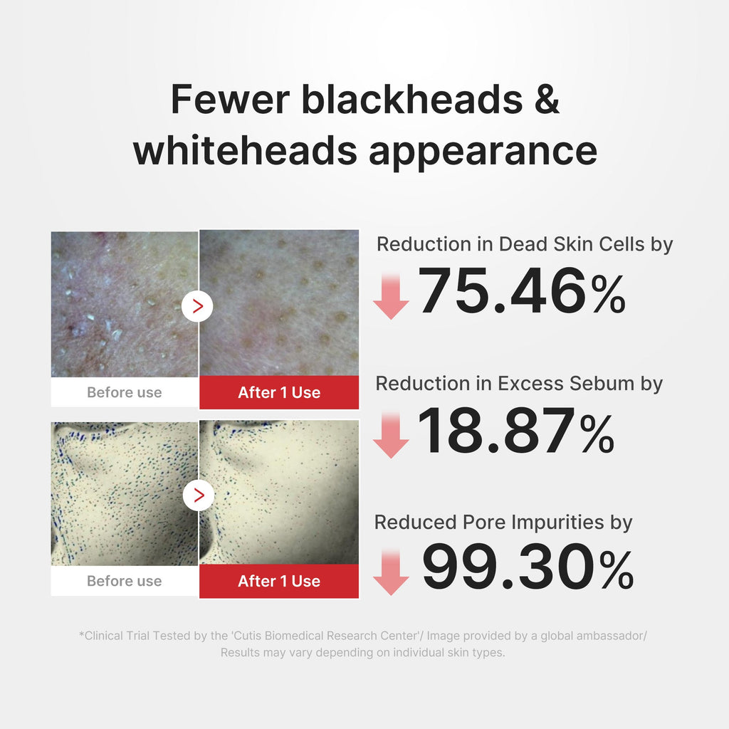 Hypochlorous Acid Rice Peel Shot - Beauty with a personal touch.