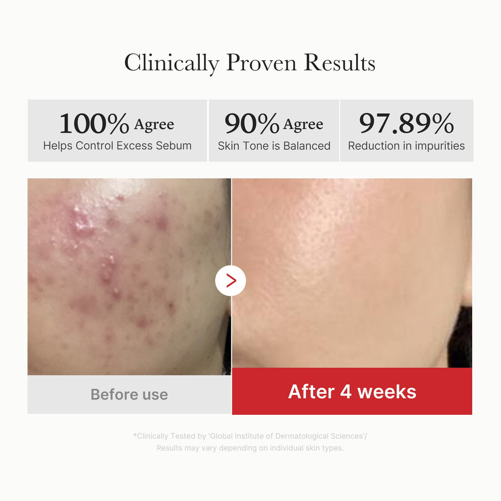 Red Succinic Acid Panthenol Pads - Care belongs on your calendar.