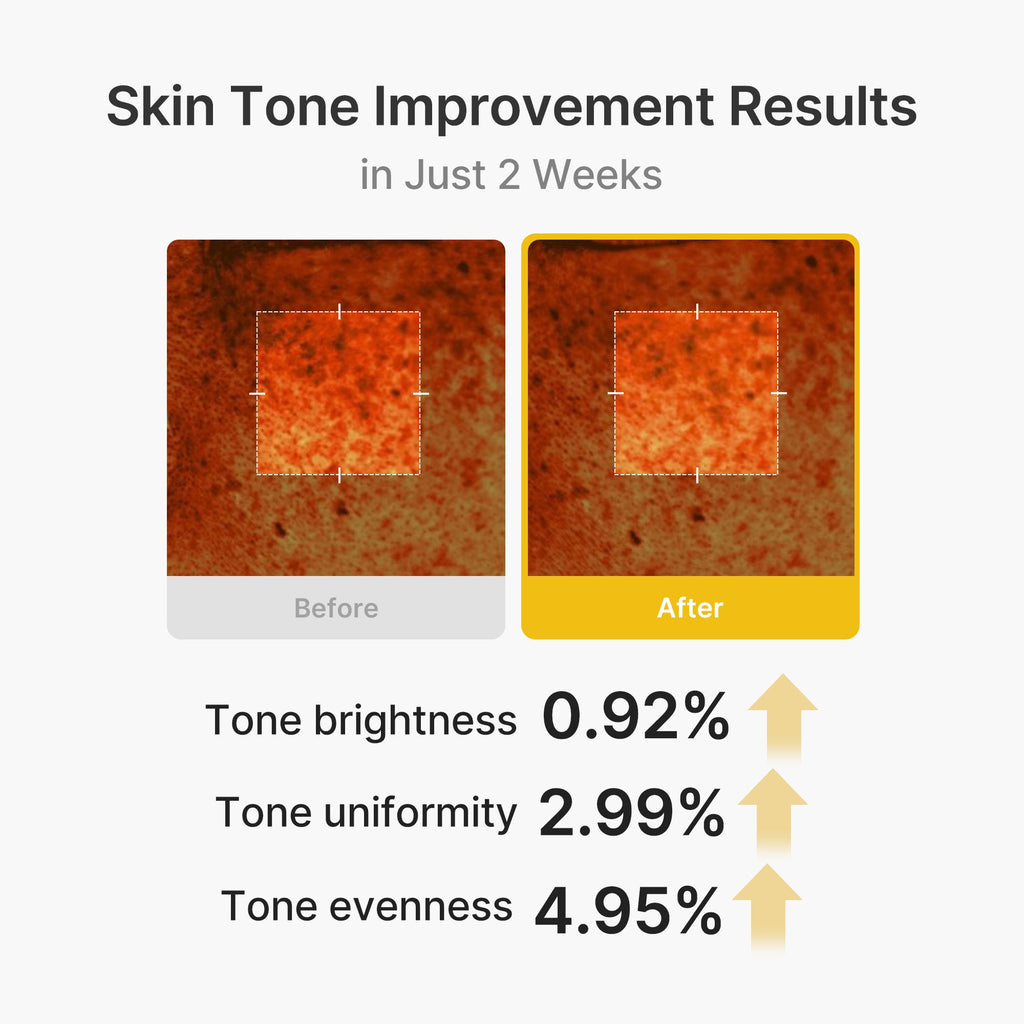 Kojic Acid Turmeric Vita Capsule Cream - Make skin care your own.