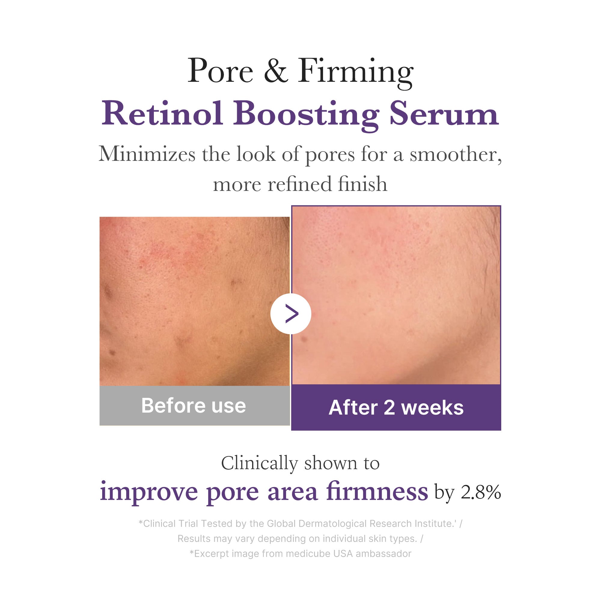 Retinol NMN Boosting Serum - Skincare meets your rhythm.