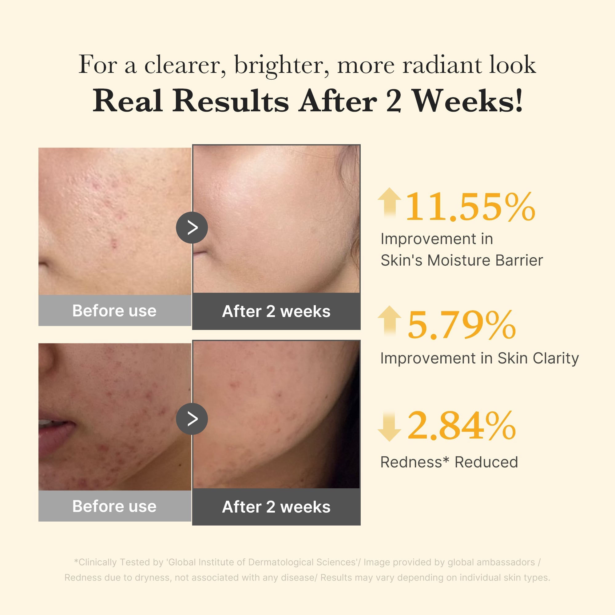 Kojic Acid Turmeric Capsule Serum - More love for your skin.