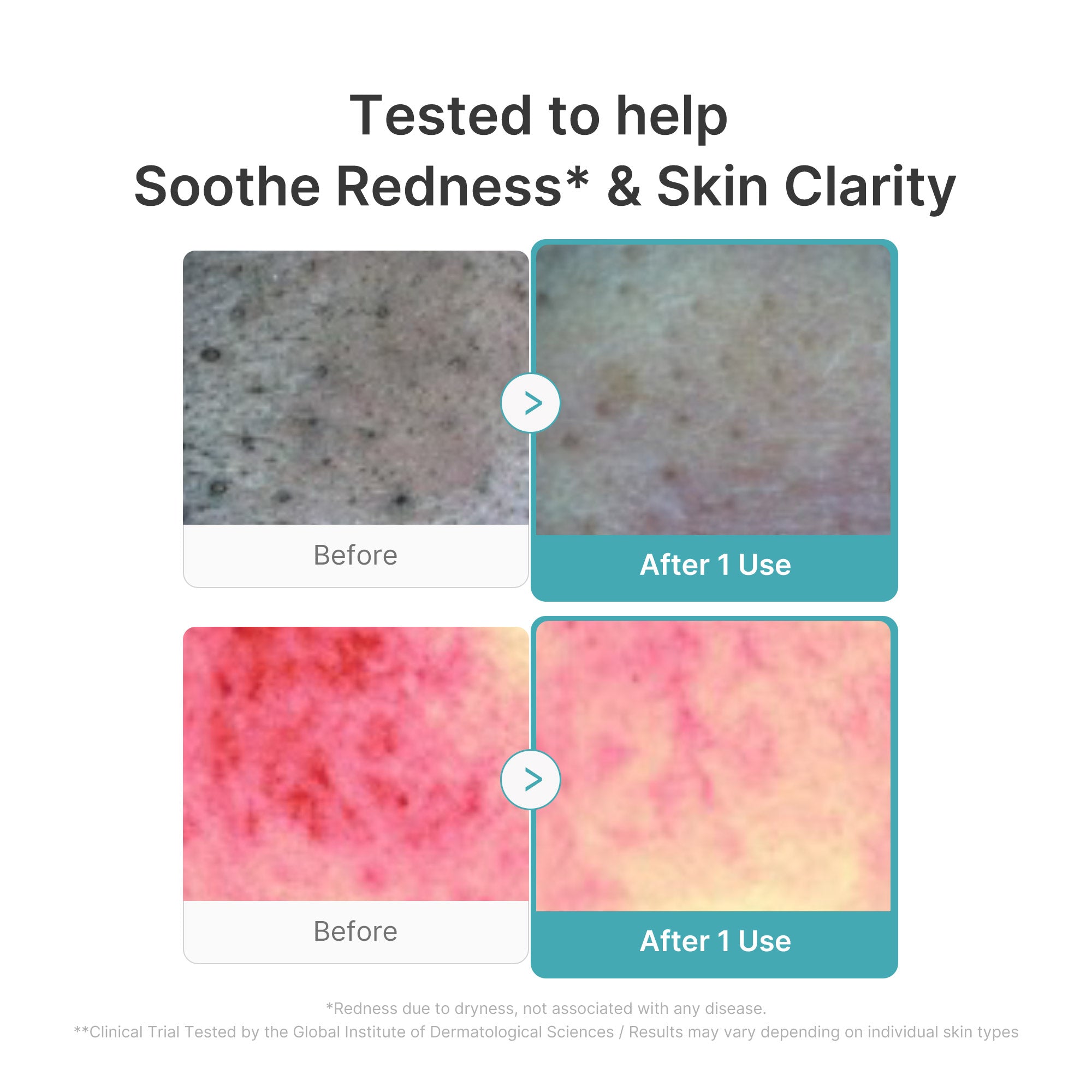 Azelaic Acid Capsule Foam Cleanser - Small rituals. Big mornings.