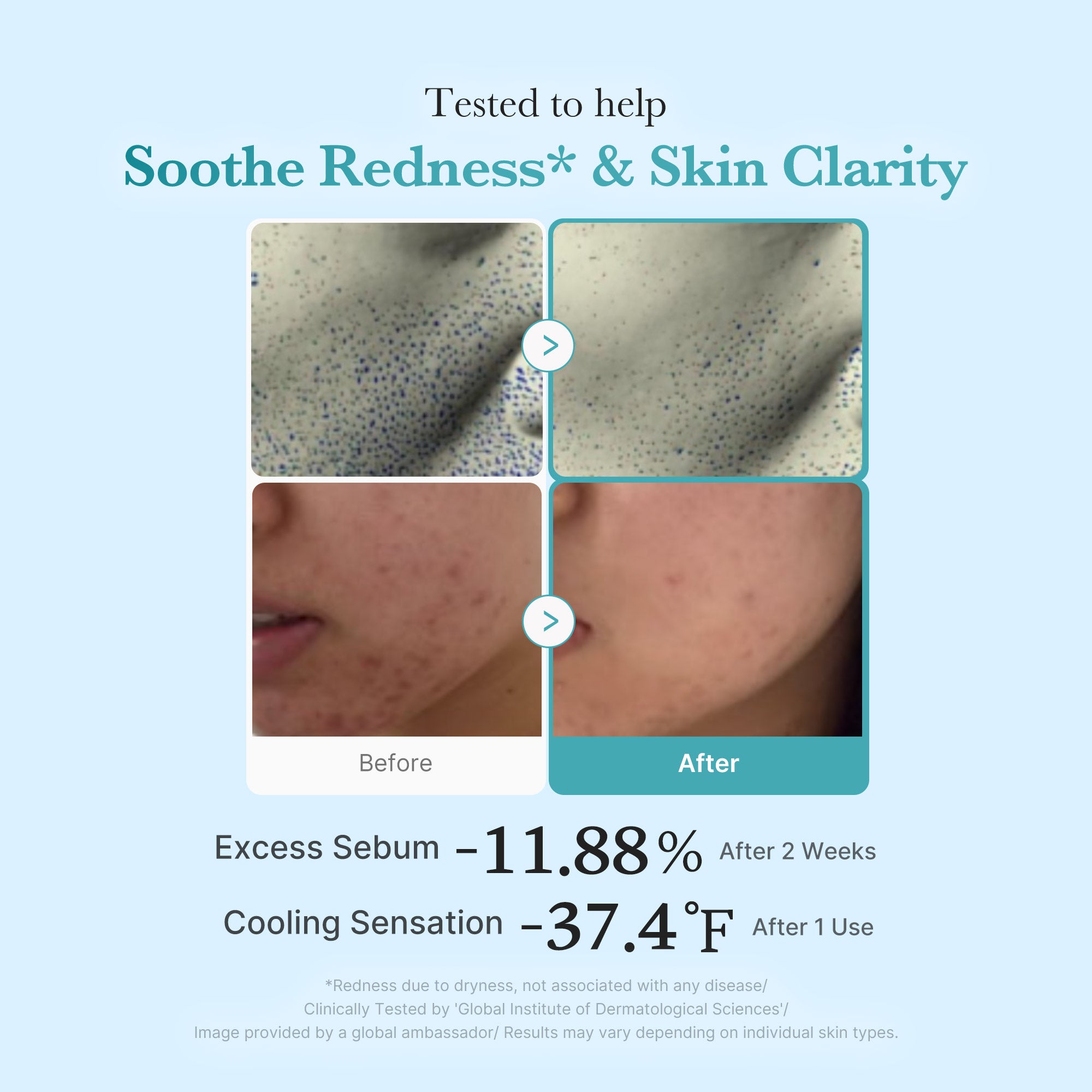 Azelaic Acid Niacinamide Clarifying Toner - Your slow morning starts here.