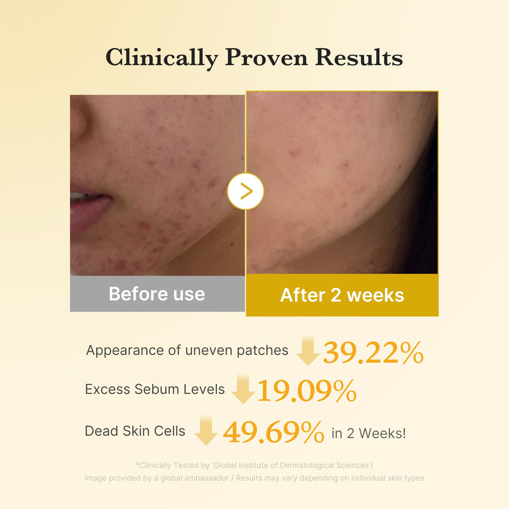 Kojic Acid Turmeric Toner Pad - Take five for yourself.