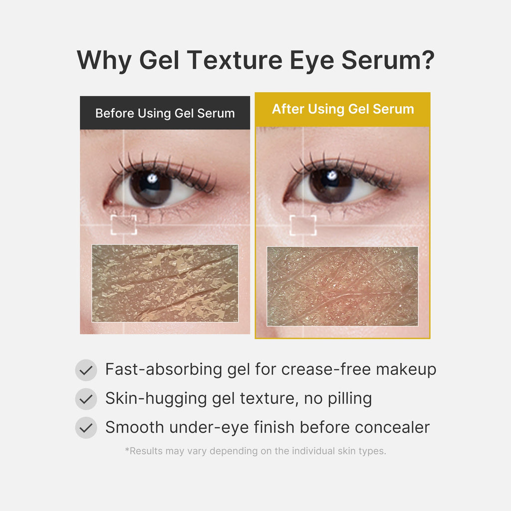 Kojic Acid Turmeric Eye Gel Serum - Bring your love of beauty.