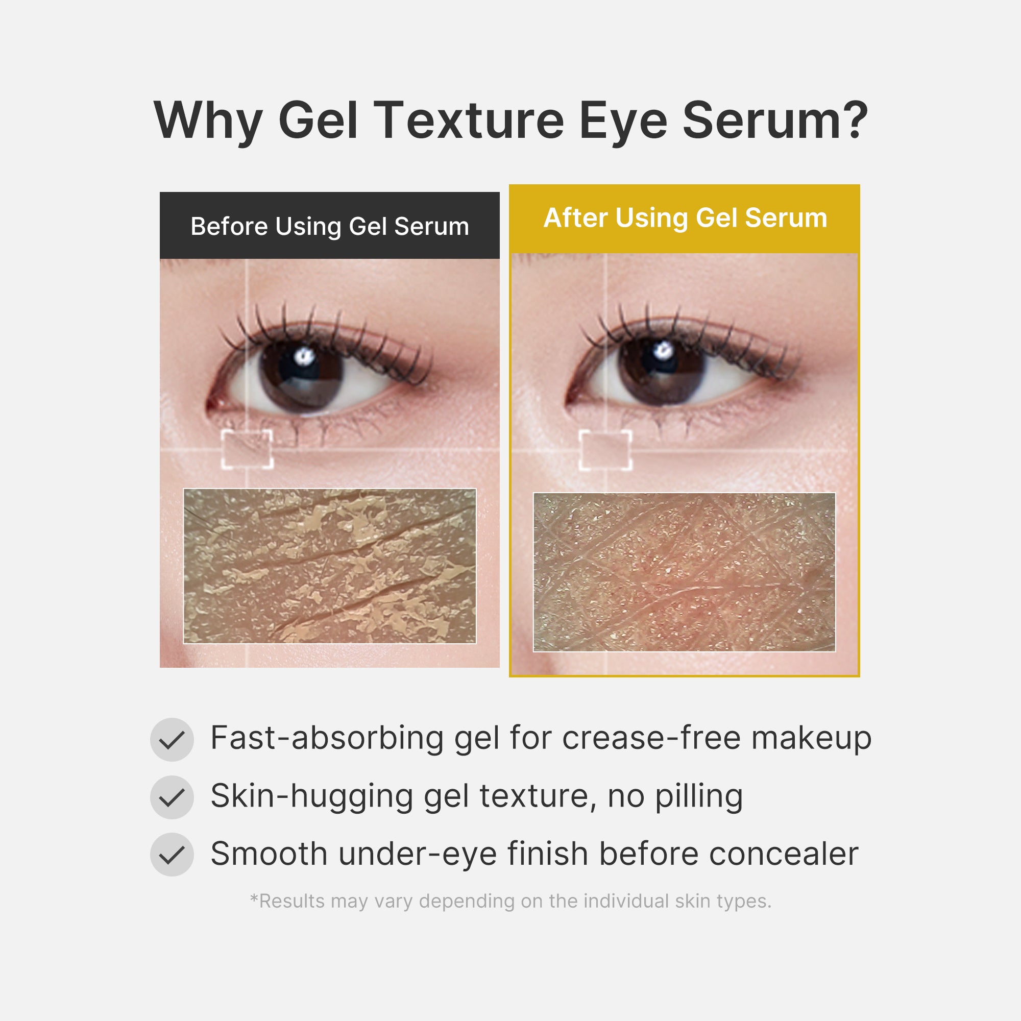 Kojic Acid Turmeric Eye Gel Serum - Bring your love of beauty.