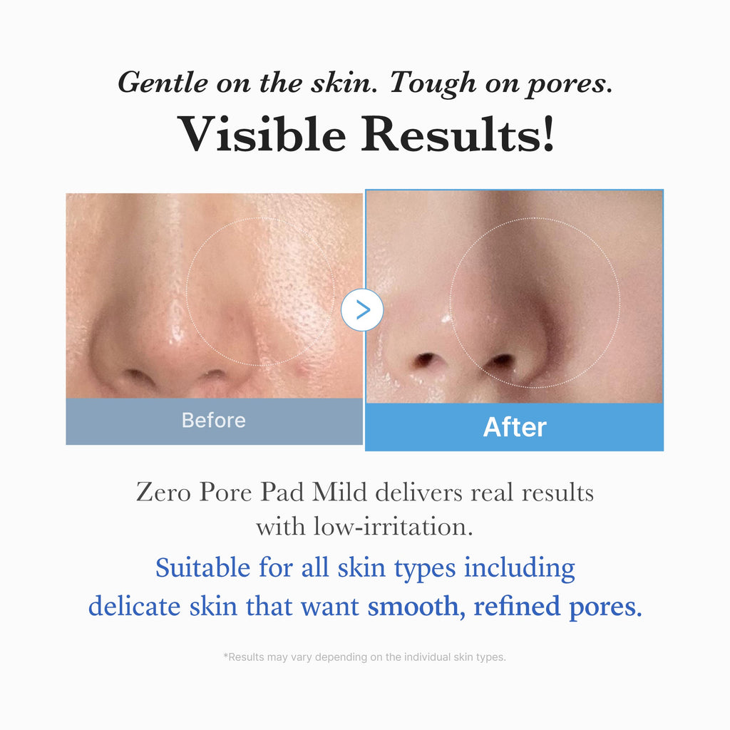 Zero Pore Madecassoside Pads (Mild) - Find your own skincare way.
