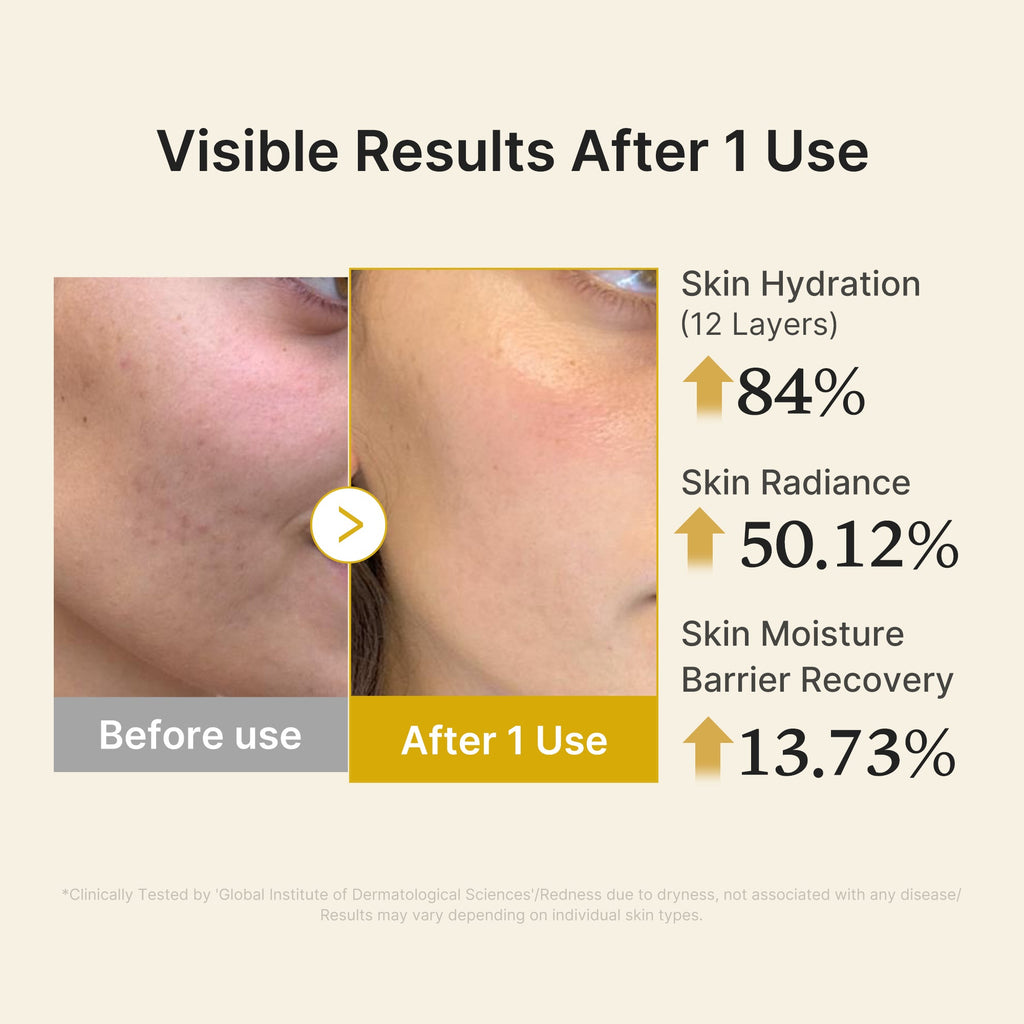 Kojic Acid Turmeric Vitamin Gold Jelly Mist Serum - Stay curious about skincare.