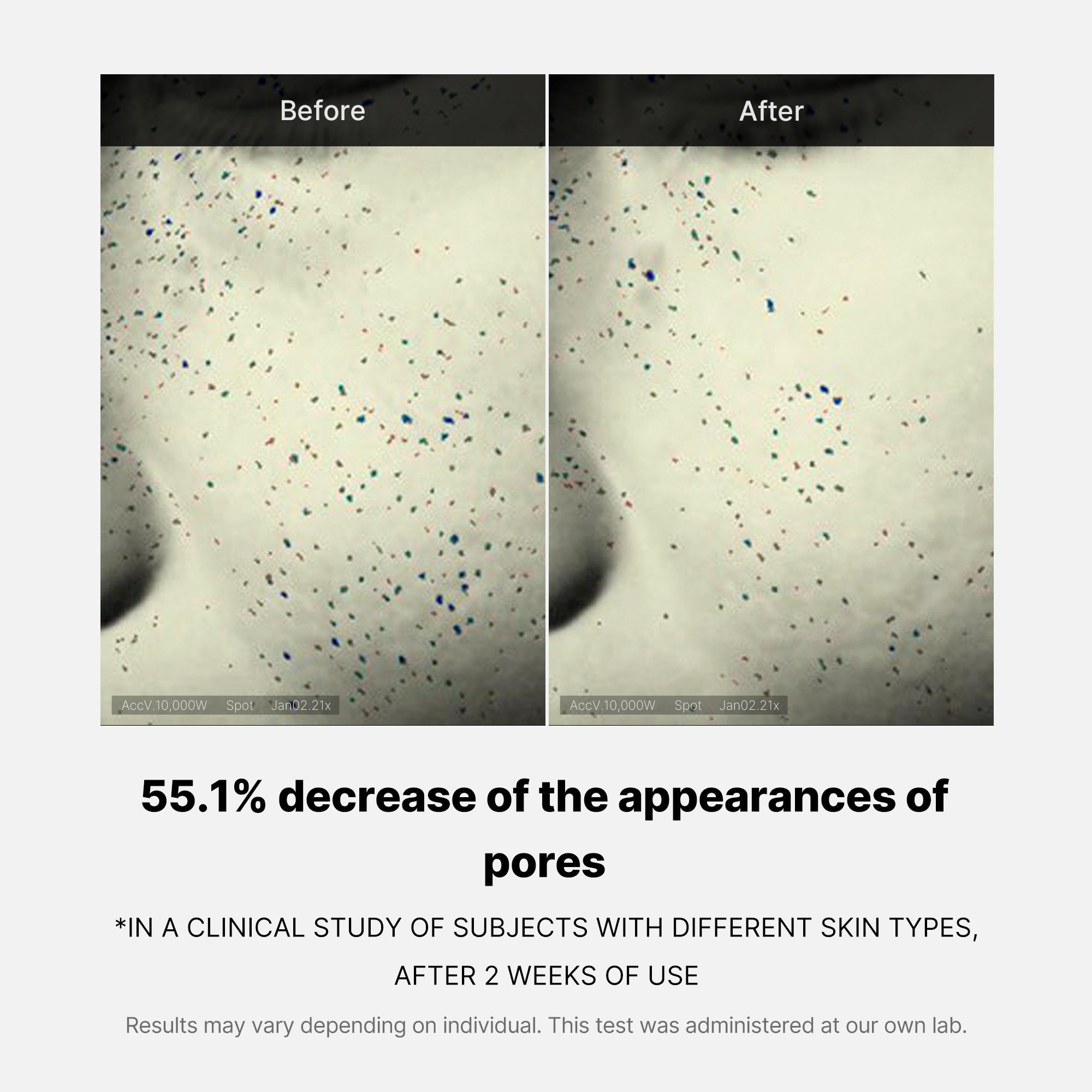 Pore Care Duo - Put yourself on the list.