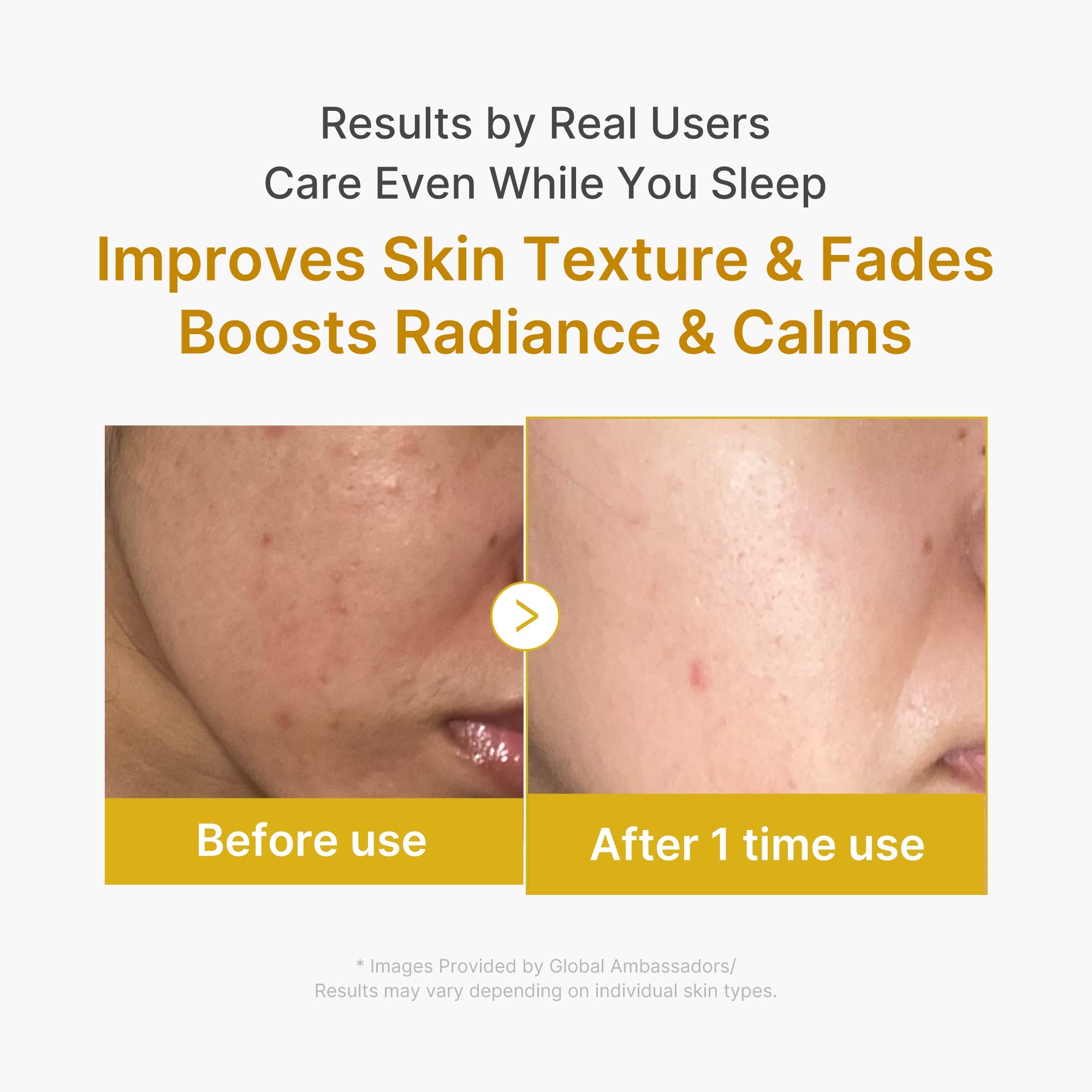 Kojic Acid Turmeric Overnight Wrapping Mask - Medicube fits your ritual.