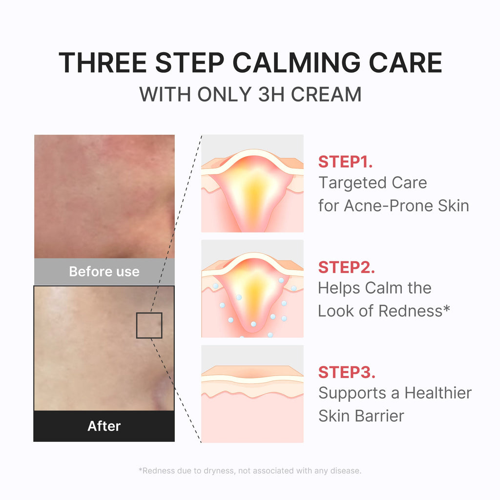 3H Daily Relief Cream - Care at your own pace.