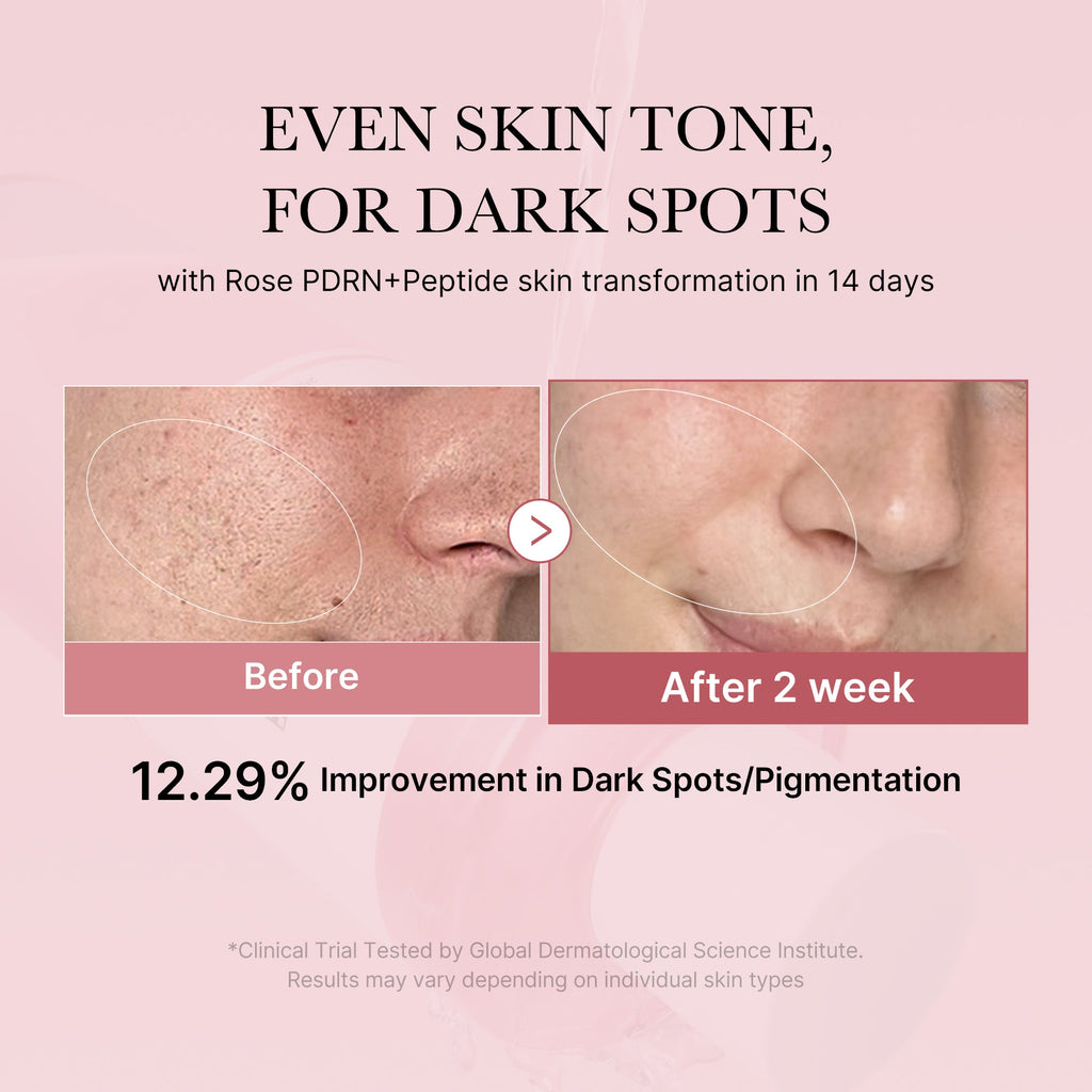 PDRN Pink Peptide Toner - Give them a beauty moment.