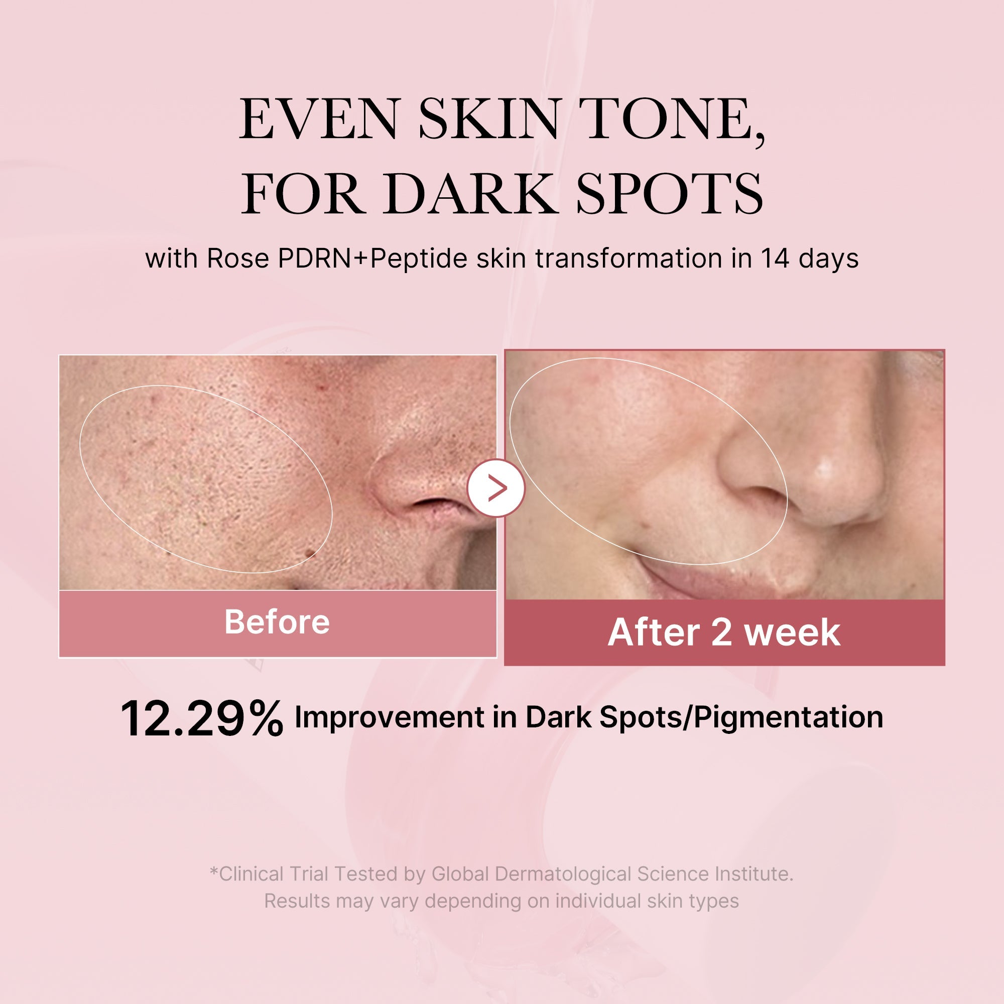 PDRN Pink Peptide Toner - Give them a beauty moment.