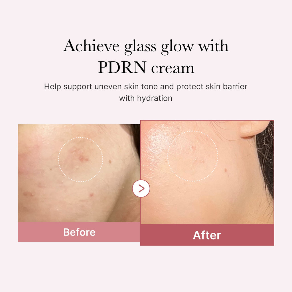 PDRN Pink Peptide Cream - Your schedule needs a pause.