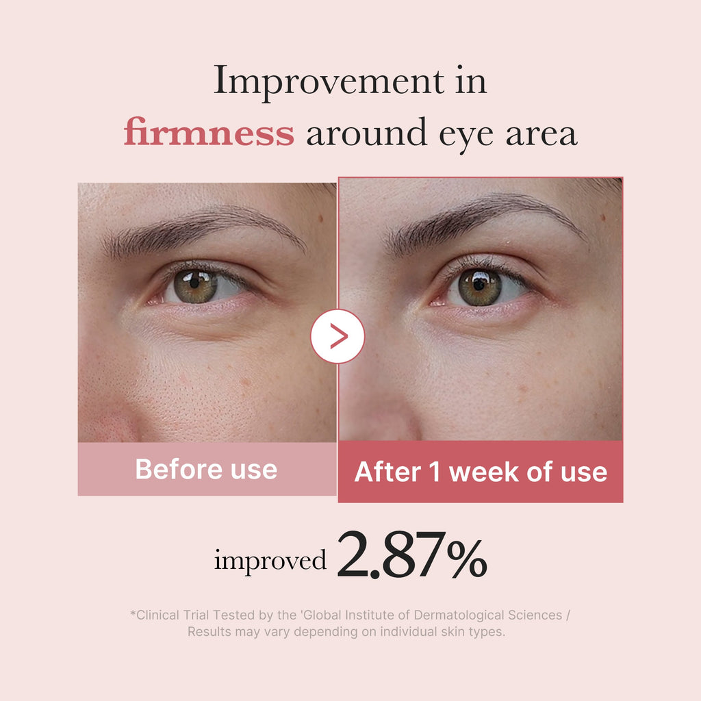 PDRN Pink Peptide Eye Cream - Take your morning back.