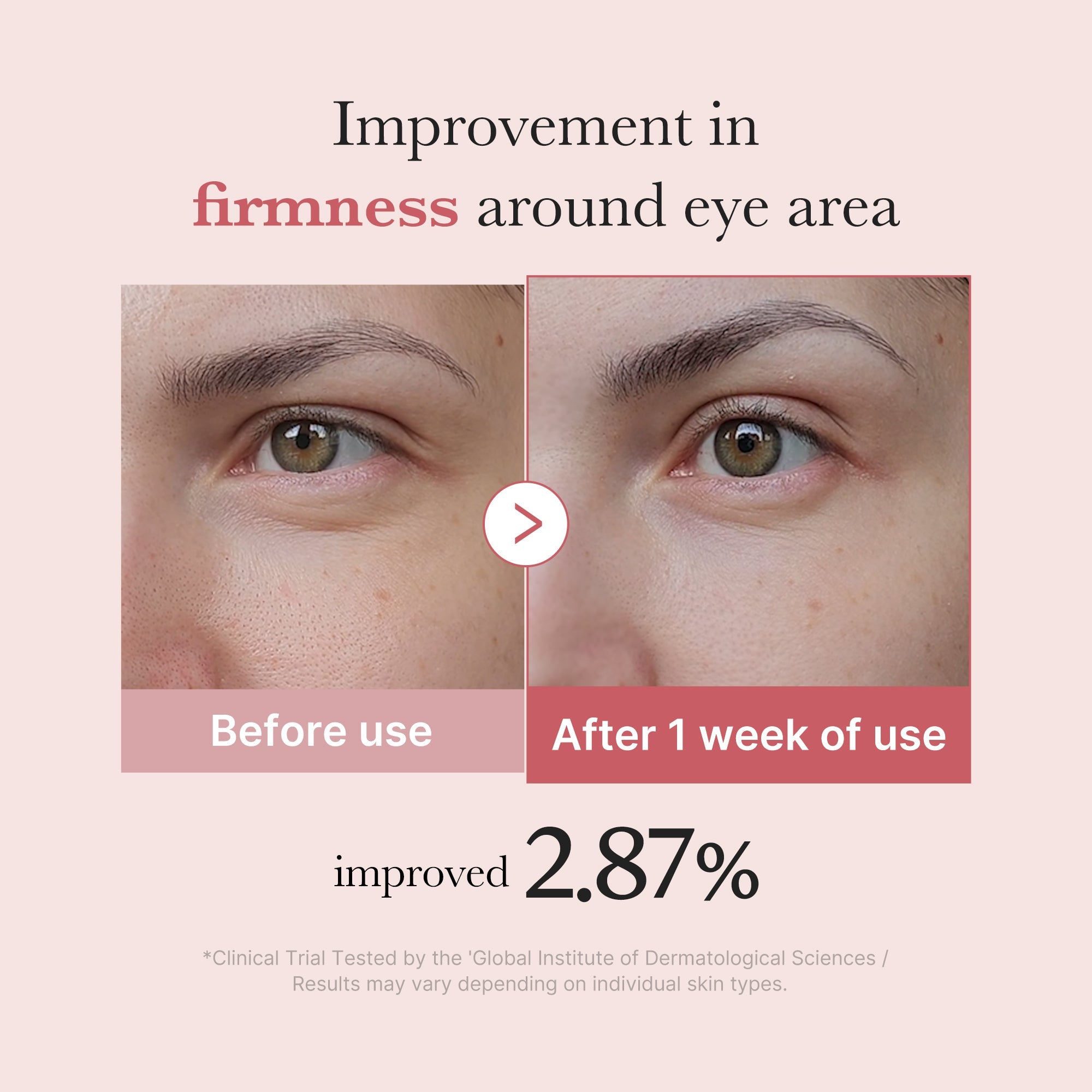PDRN Pink Peptide Eye Cream - Take your morning back.