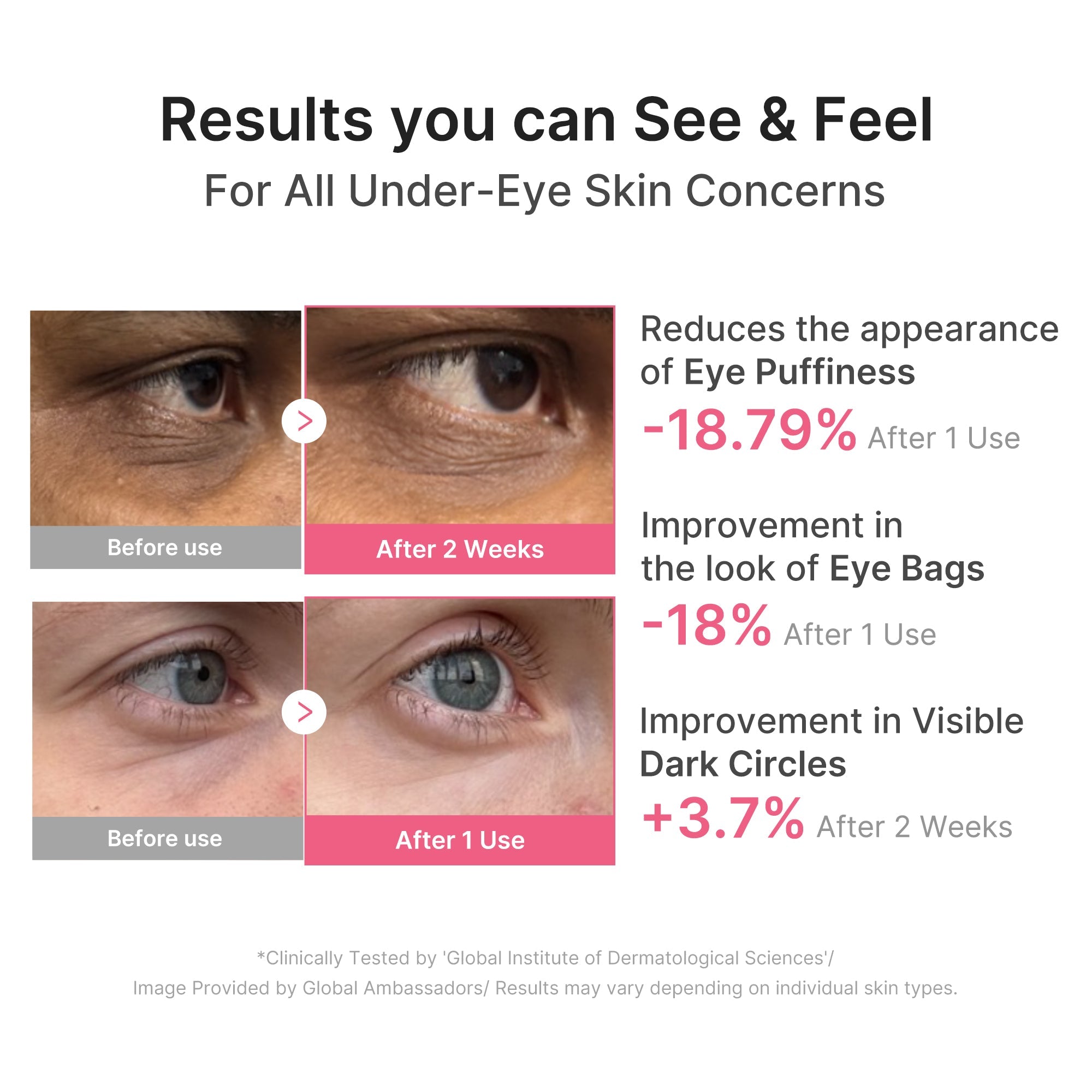 PDRN Caffeine Collagen Eye Patch - Your plans can include you.