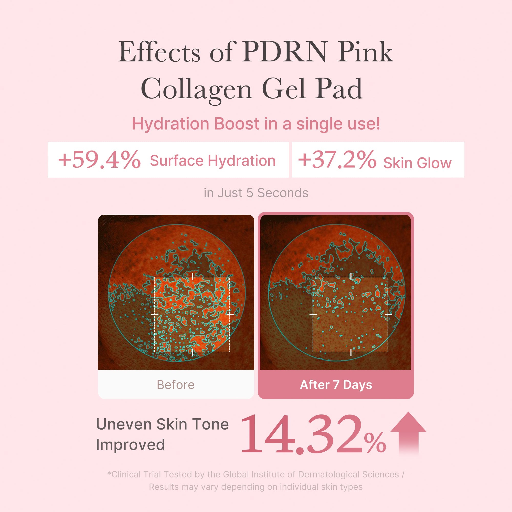 PDRN Pink Collagen Gel Toner Pad - Beauty talk is always welcome.