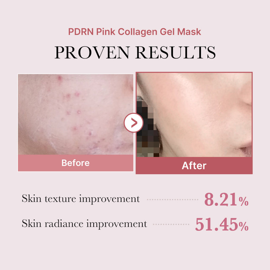 Salmon PDRN Pink Collagen Jelly Gel Mask - Let skincare set the pace.