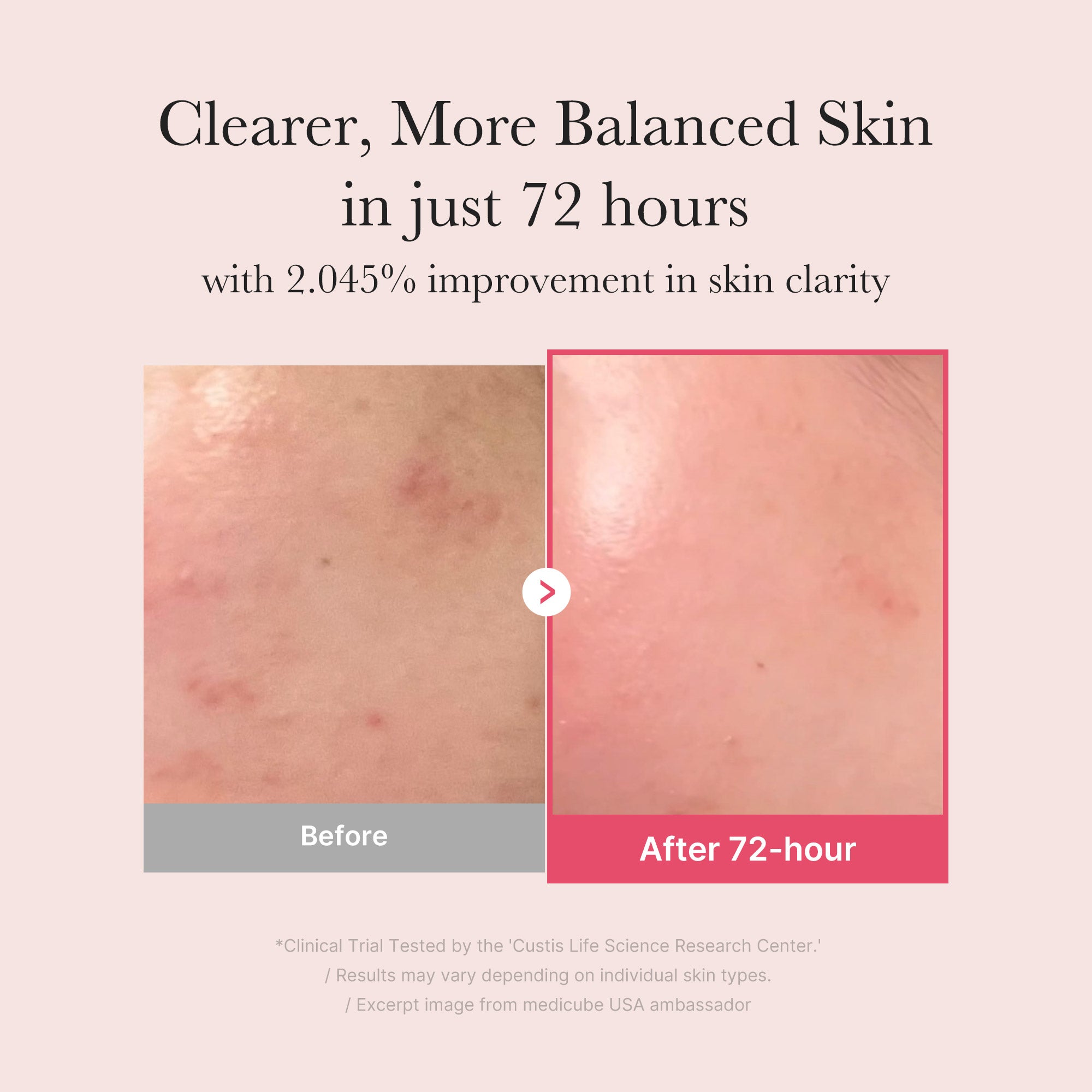 TXA Niacinamide Serum - Your evening intermission.